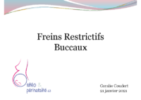 Frein Restrictifs Buccaux